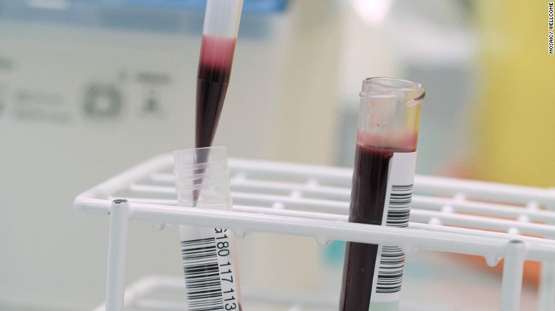 FDA panel endorses potential 1st United States gene therapy FDA panel endorses potential 1st United States gene therapy